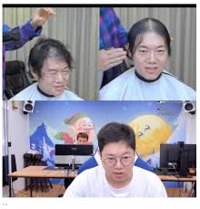 이날 김지혜는 남편의 모발이식 사실을 폭로했다. í¬ëª¨ìŠ¤ ê°ìŠ¤íŠ¸ ëª¨ë°œì´ì‹ ì „ Vs í›„