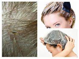 schadigt haarfarbemittel lause und nissen