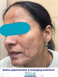 🌿 A Skin Journey Built