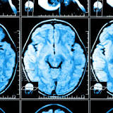 Image result for how can my attorney prove i have a mild tbi
