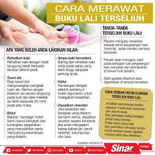 Cedera pergelangan kaki buku lali adalah kecederaan pada pergelangan kaki yang timbul akibat ligamen mengikat, yang merupakan tendon (2018). Buku Lali Terseliuh Buku Lali Biden Terseliuh Ketika Bermain Dengan Anjing