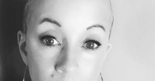 Sports Reporter Boldly Embraces Losing Hair To Breast Cancer Treatment