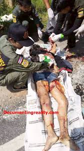 Please note, the videos in this forum are gory, so be warned. Woman On Scooter Dead Under Wheels Of Truck