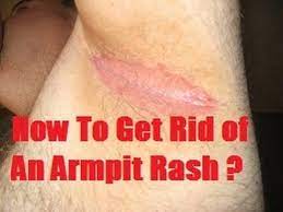 Of course, allow the rash a couple days to heal between the changes. Are You Worry How To Get Rid Of An Armpit Rash How To Get Rid Of Dark Underarms Overnight Youtube Armpit Rash Rashes Rash Treatment
