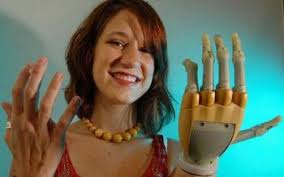 Invented by David Gow in 2007, the device, known as the iLIMB, became the world&#39;s first ... - ilimb-bionic-hand