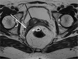 The paired uterosacral ligaments are one of the supporting structures of the uterus. Epos Trade