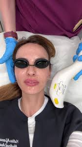 ✨In @timarronaestheticcenter , we’ve utilized cutting-edge technologies  like Pixel and Stellar M22 for flawless skin perfection. ☺️ , Additionally,  to address a wide range of concerns, we also employ ...