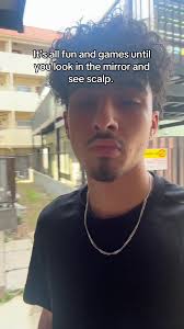 Looked in The Mirror Bald Hair