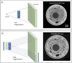 Learn about ct scan or cat scan. Osa Flexct A Flexible X Ray Ct Scanner With 10 Degrees Of Freedom