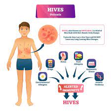 Pin On Healthcare Illustration
