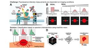 “Revolutionizing Cancer Surgery: Multispectral Infrared Imaging with Machine Learning”
