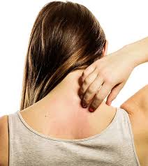Participants applied the oils to areas of itchy skin twice a day. 21 Home Remedies To Get Rid Of Rashes On The Face Diet And Prevention Tips