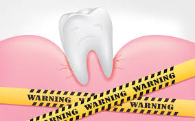 I M 9 Years Post Op Losing My Teeth Bariatric Surgery Sleeve Post Op Bariatric Sleeve