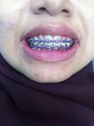 Klinik Pergigian Dr Azreen Sungai Petani Facebook