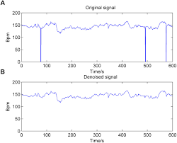 Frontiers Computer Aided Diagnosis System Of Fetal Hypoxia