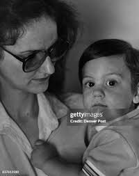 61 Craniosynostosis Stock Photos, High-Res Pictures, and Images