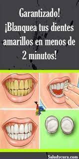 Garantizado Blanquea Tus Dientes Amarillos En Menos De 2 Minutos Blanquea Blanqueardientes Dientesamarillos Dental Health Oral Health Care Health Tips