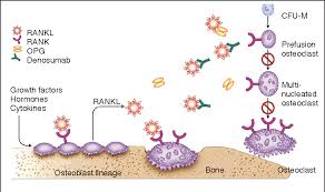Image result for Denosumab