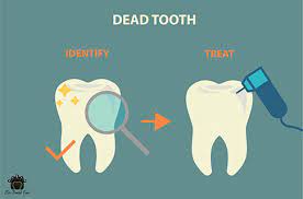 Maybe you would like to learn more about one of these? Signs Of A Dead Non Vital Tooth St Lawrence Dentistry