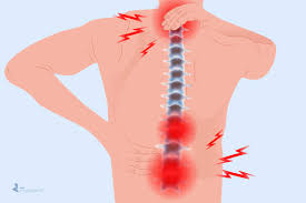 The rib cage is the arrangement of ribs attached to the vertebral column and sternum in the thorax of most vertebrates, that encloses and protects the vital organs such as the heart. Arthritis In The Back Symptoms Types Of Back Arthritis Treatment