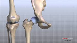 I can't straighten or put any pressure on my leg. Knee Physiopedia