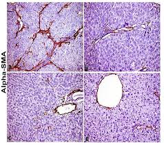 Image result for Aeschynomene elaphroxylon