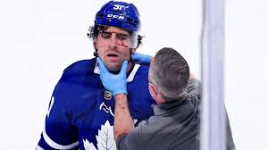 The official 2020 roster of the montréal canadiens, including position, height, weight, date of birth, age, and daoust discusses the role of the centre 21.02 in providing a place for women's hockey players to train and in montreal canadiens and canadiens.com are trademarks of the montreal canadiens. Toronto Maple Leafs John Tavares Carted Off Ice Taken To Hospital After Hit To Face
