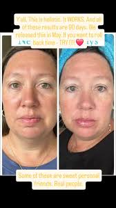#holisticskincare #realresults