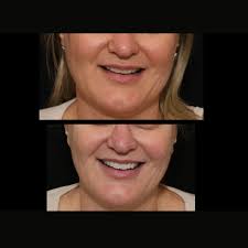 Iconic Dentistry (@iconicdentistry) • Instagram photos and videos