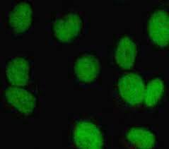 Some people saw the images of red blood cells under the microscope. Normal Chang Liver Cells Under Fluorescence Microscope A Untreated Download Scientific Diagram