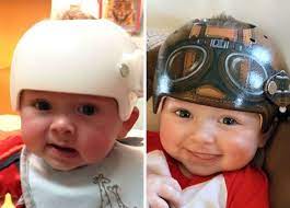 Artist Transforms Babies Head Shaping Helmets Into Beautiful Art Baby Helmet Baby Helmet Design Baby Helmet Design Boys