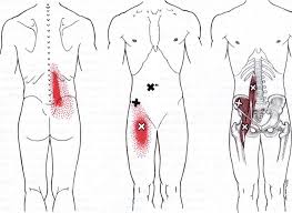Travell Trigger Points Tourismstyle Co