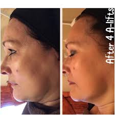 Sponsored blog: How I grew my client base by introducing one new treatment