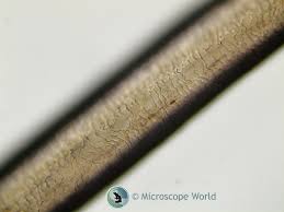 Maybe you would like to learn more about one of these? Hair Analysis Under The Microscope