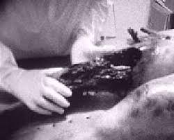Resultado de imagen para alien autopsy