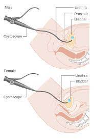 Female anatomy diagram urethra female reproductive system view. Cystoscopy Wikipedia