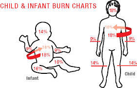 Solutions Charting For Nurses Rule Of 9 Burns Pediatrics