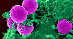 Mrsa are staphylococcus bacteria that have become resistant to certain antibiotics. Staph Infections The Nose Knows How To Fight Them Science News For Students