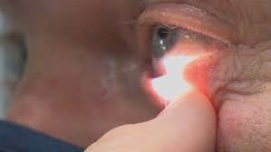 Centers for disease control and prevention. Covid 19 Don T Forget To Protect Your Eyes Wlos