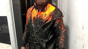 Workers Expose Shocking Conditions Inside Melbourne Factory That Blew Up Abc News Worker Melbourne Leslie White