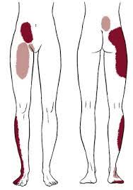 If you feel the pain and interpret it as an important alarm signal, you can take effective action against it. Sacroiliac Joint Dysfunction Osteopath In Hatfield
