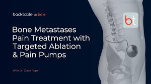 Image result for Intrathecal Pump