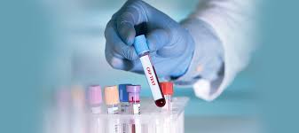 ¿qué es la proteína c reactiva? Totul Despre Proteina C ReactivÄƒ Smart Medical