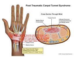 Medical Exhibits Demonstrative Aids Illustrations And Models