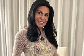Transplante de Gretchen por alopecia: médicos explicam queda de cabelo