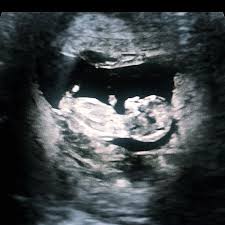 Julia stiles is a mama! J Cook On Twitter Daddy S You Can T Wait To Meet You In April