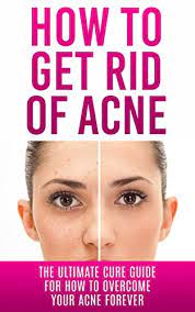 Amazon.com: How To Get Rid Of Acne: The Ultimate Cure Guide For How To  Overcome Your Acne Forever (Acne Cure, Acne Treatment, Acne No More, Acne  Diet, How To Get Rid Of