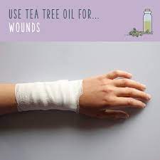 Tea Tree Oil Uses 70 Ways To Benefit From Tea Tree Oil Tea Tree Oil Uses Tea Tree Oil Tree Oil