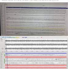 Badan meteorologi, klimatologi, dan geofisika (bmkg) memastikan suara dentuman dini hari yang terdengar di jakarta hingga bogor bukanlah akibat aktivitas tektonik. Suara Dentuman Di Malang Bmkg Sebut Tak Ada Anomali Seismik Kabar24 Bisnis Com