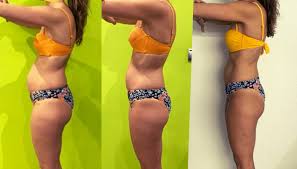 Violeta Before After